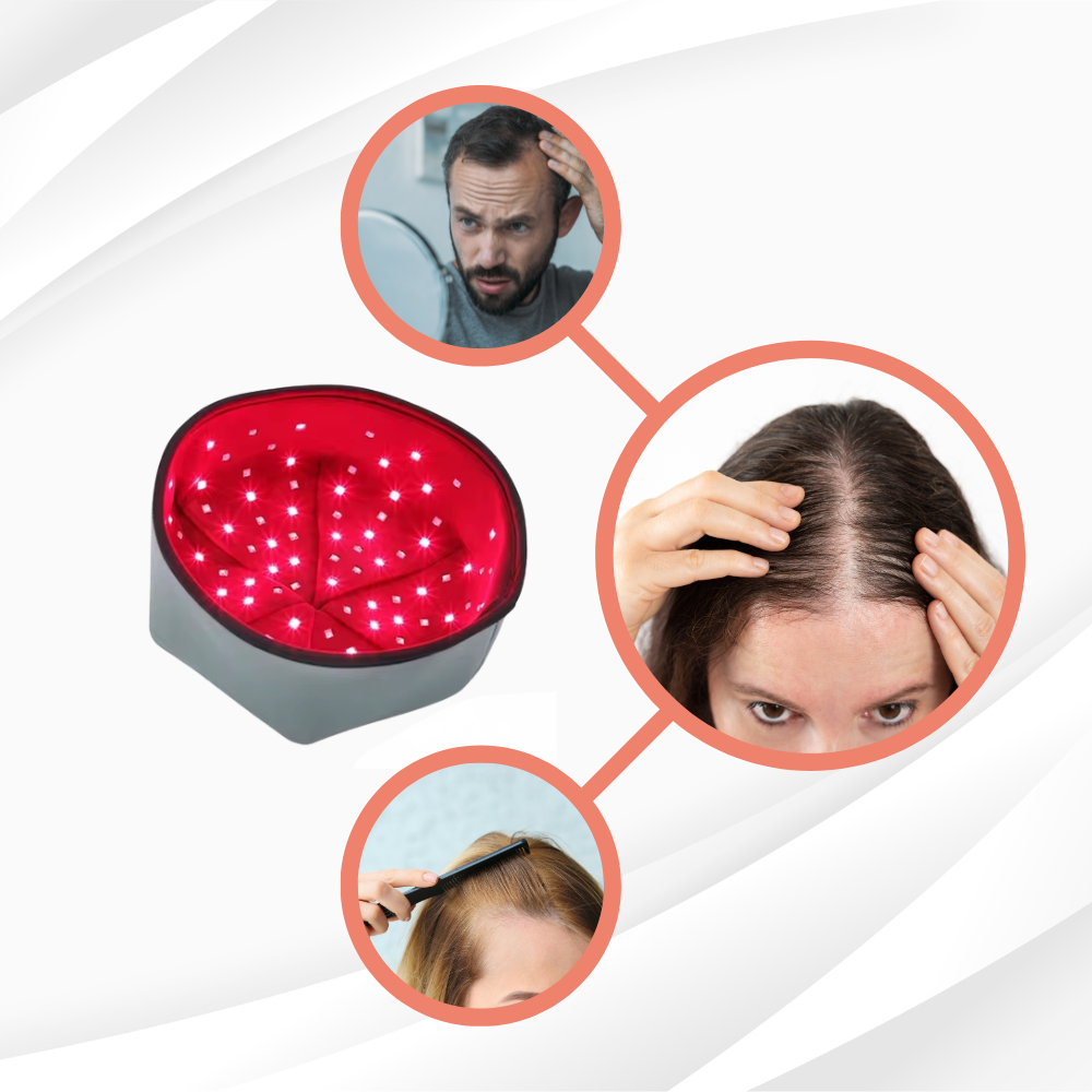 cheveux fins et fragiles, alopécie et perte de cheveux